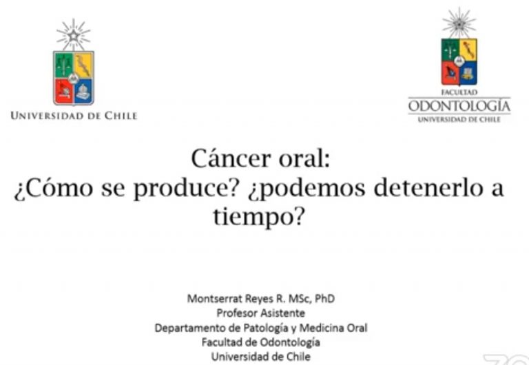 [Charlas: Ciencia Abierta]: Cáncer oral: ¿Cómo se produce y cómo podemos detenerlo a tiempo?
